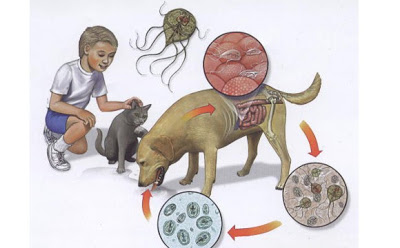 Trichomonas pyelonephritis